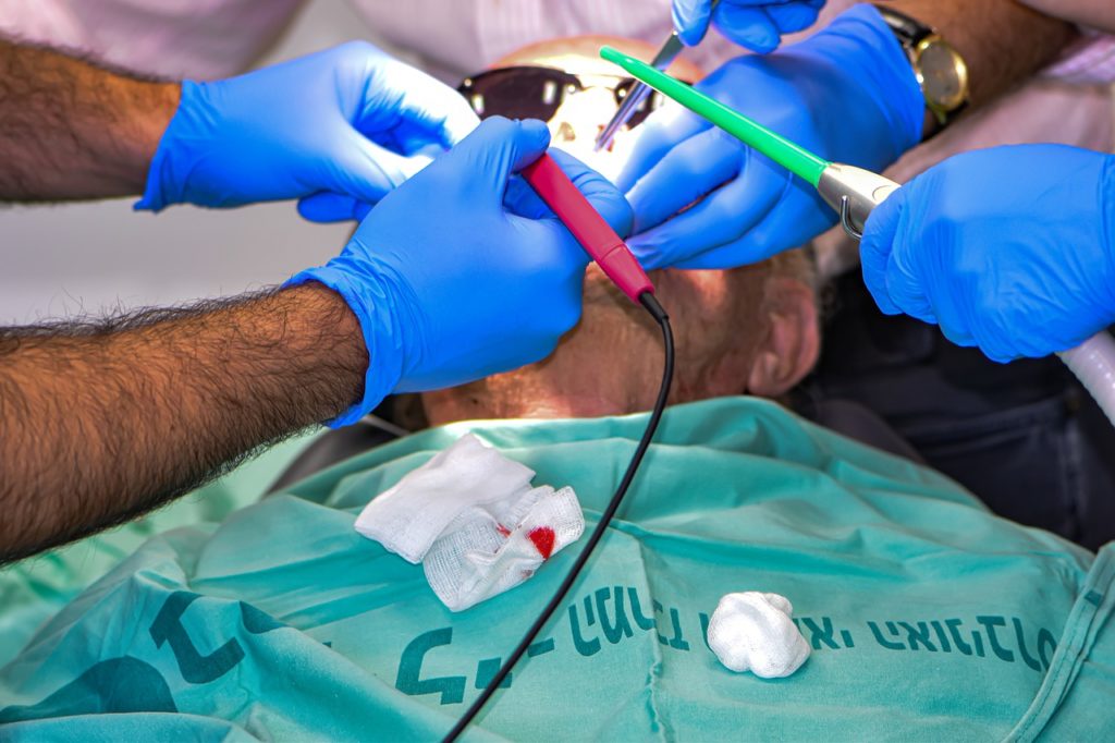 ניתוח השתלת שיניים - איך להתכונן לניתוח