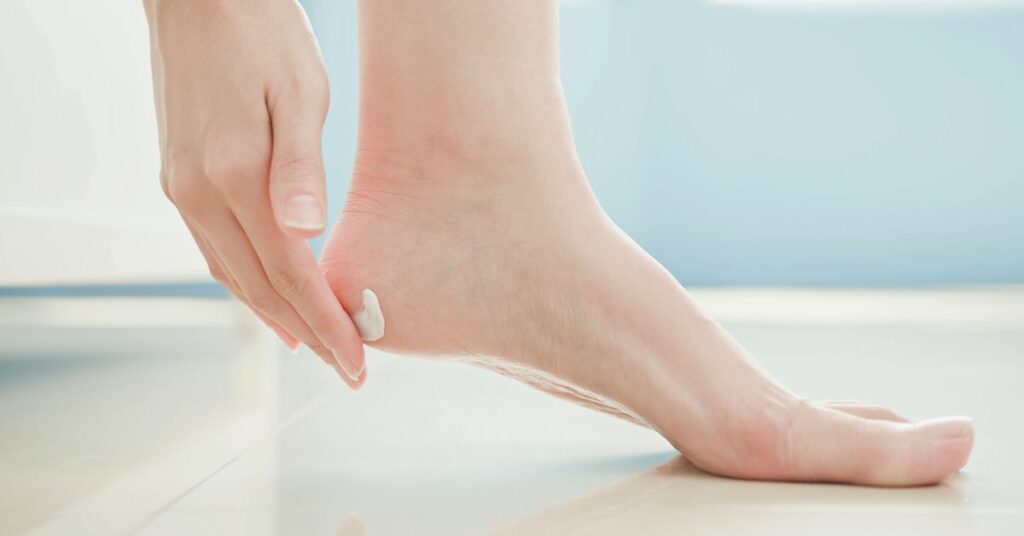 איך תוכלו לטפל בכפות הרגליים שלכן – השלב ה – 2 למרוח קרם רגליים טיפולי